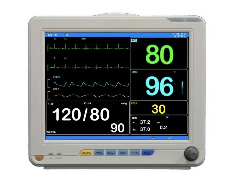 Monitor ECG